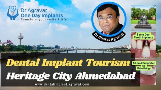 Dental Implant Tourism Heritage City Ahmedabad Dr